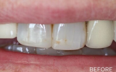 Smile gallery before