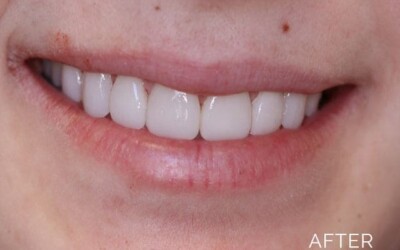 Donald G. Guebert, DMD patient after teeth whitening