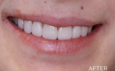 Donald G. Guebert, DMD patient after teeth whitening