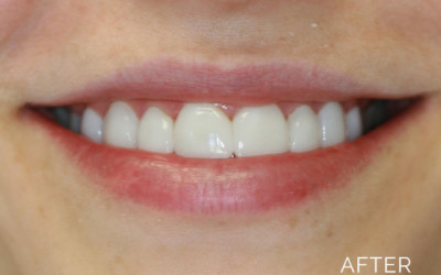 Donald G. Guebert, DMD patient after teeth correction